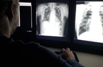 Lung Energy Peaks in Our 20s—and It is a Regular...